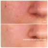 DOCTOR BABOR - HYDRO Hydrating Bio-Cellulose Mask – Image 2