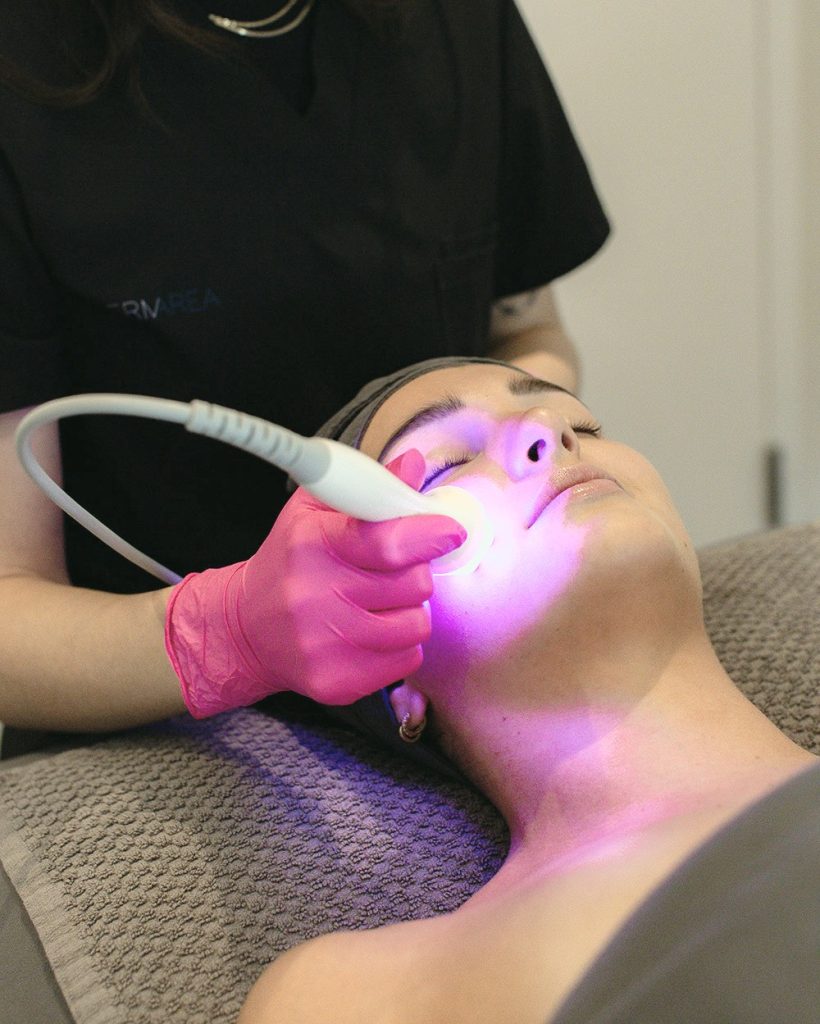 Soin Bela MD à la clinique Dermarea