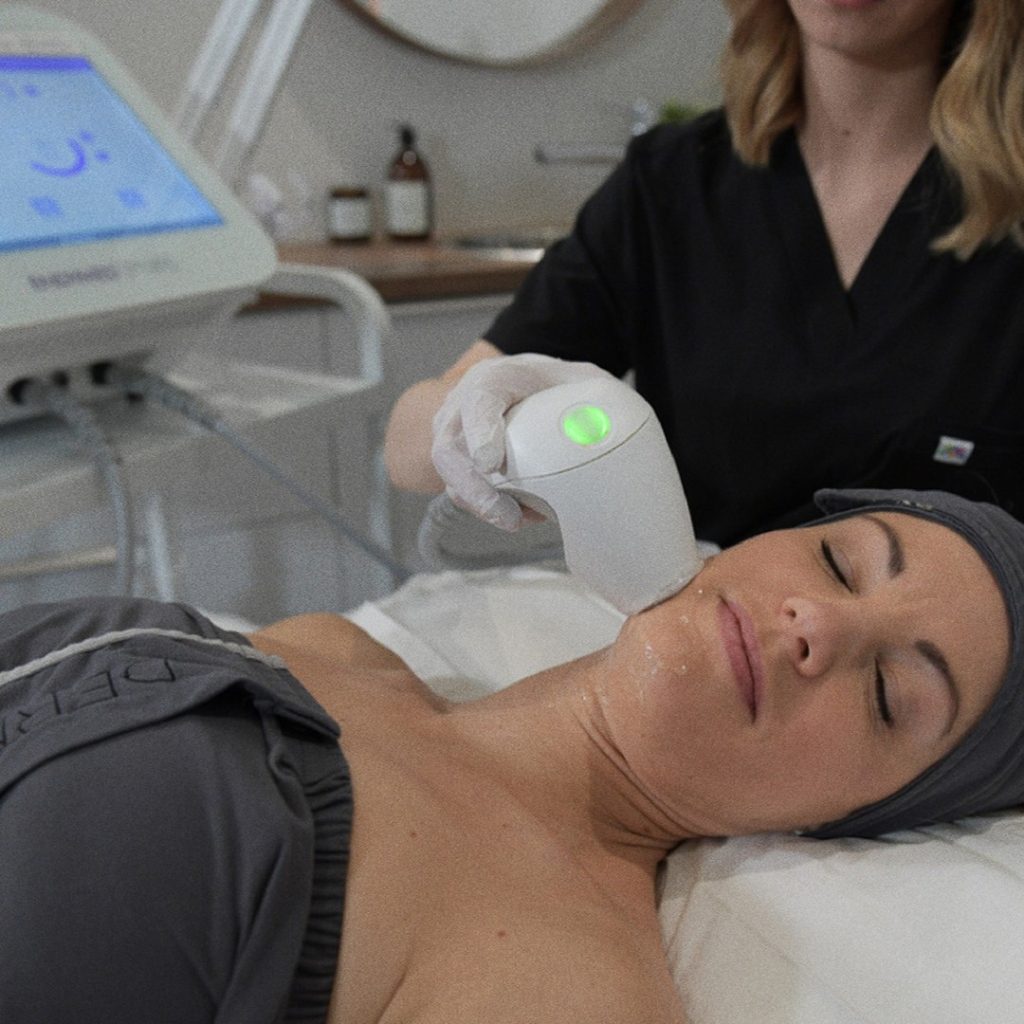Traitement de radiofréquence EndyMed 3DEEP au visage chez Dermarea