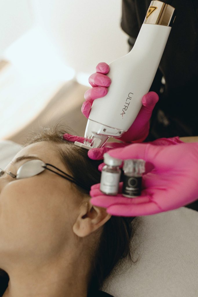 Laser Ultra pour le cuir chevelu à la clinique Dermarea