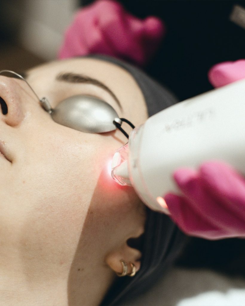 Laser Ultra pour le visage à la clinique Dermarea