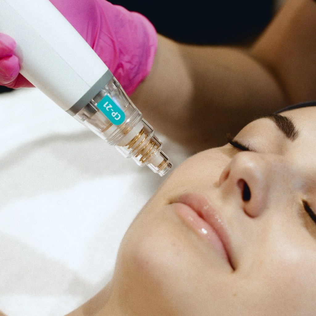 Traitement POTENZA à la clinique Dermarea