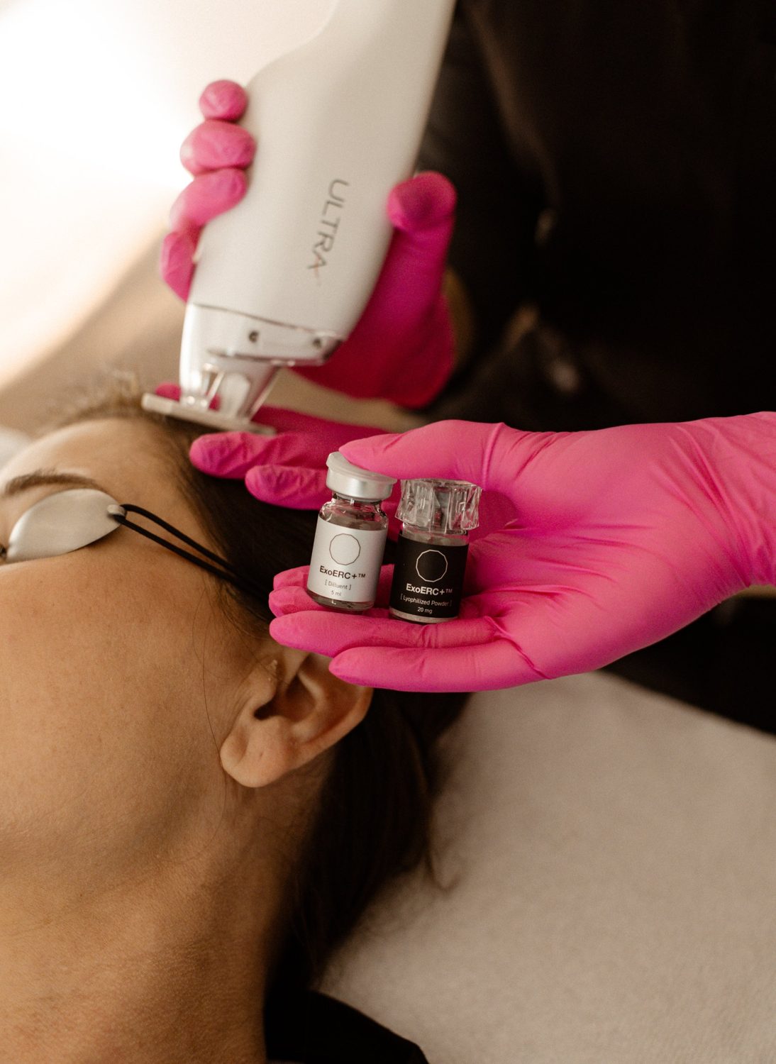 Fioles d’exosomes ExoERC+ présentées pendant un soin Laser Ultra à la Clinique Dermarea, Mirabel